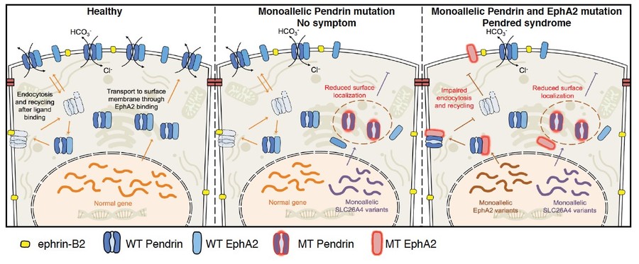 Digenic inheritance of mutations in EPHA2 and SLC26A4 in Pendred 