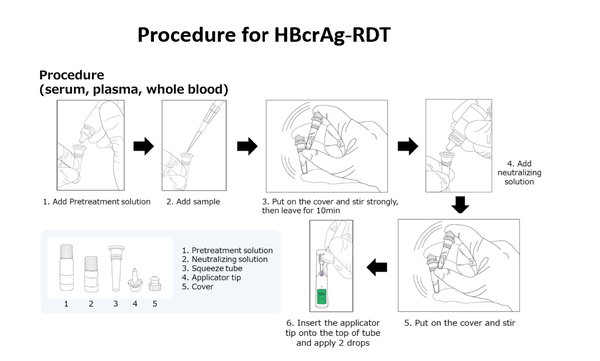 【Publications】Rapid point-of-care test for hepatitis B core-related ...