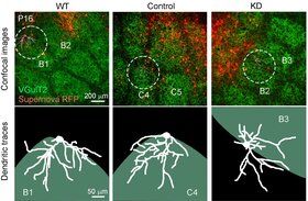 Ras GTPase-activating proteins control neuronal circuit development in barrel cortex layer 4 