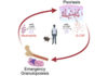 【Publications】Skin-derived G-CSF activates pathological granulopoiesis upon psoriasis