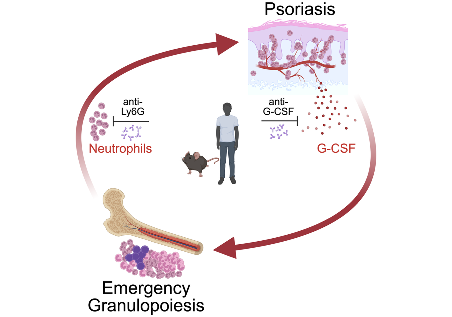 https://ircms.kumamoto-u.ac.jp/publications/images/Skin-derived%20G-CSF%20activates%20pathological%20granulopoiesis%20upon%20psoriasis.png