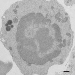 Epitranscriptome in hematopoiesis 